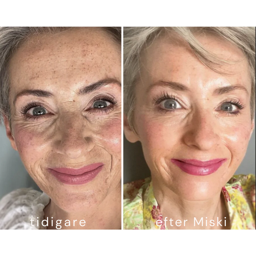 Mikro-Infusionssystem SE (BOGO)