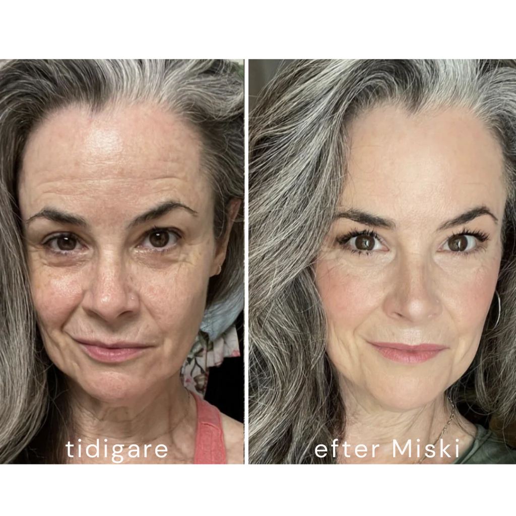 Mikro-Infusionssystem SE (BOGO)