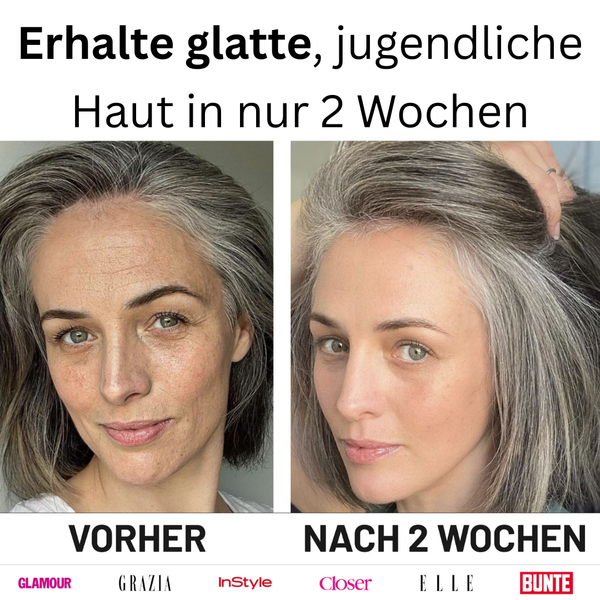 Miski Micro Infusion-System