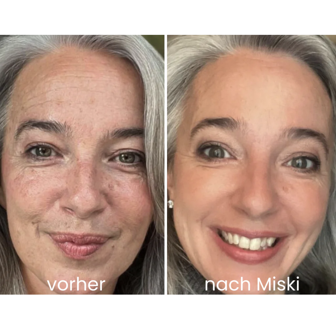 Miski Micro-Infusion-System