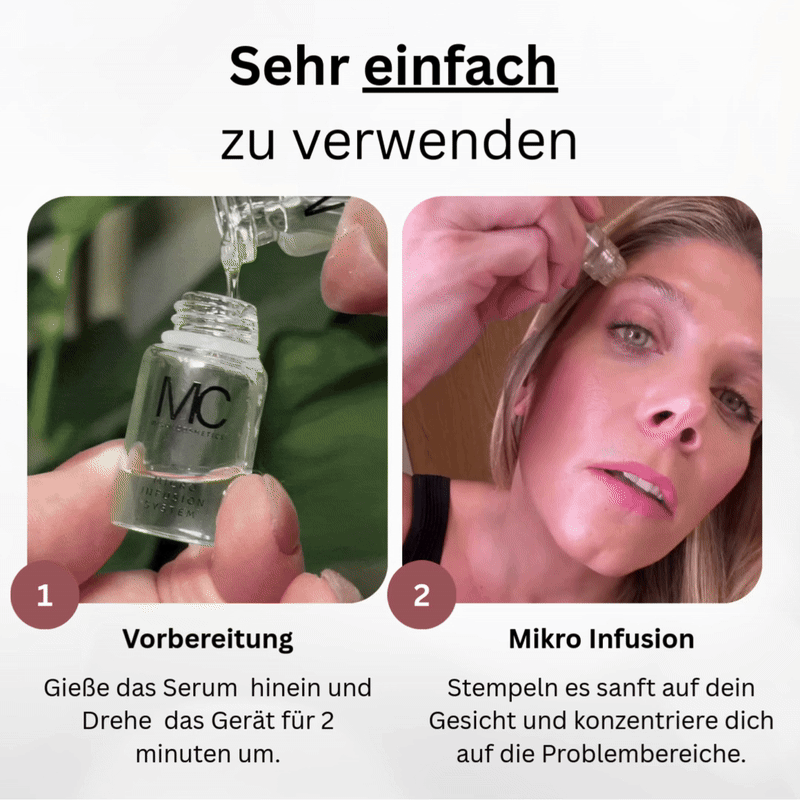 Miski Micro Infusion-System
