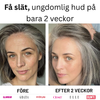 Mikro-Infusionssystem SE
