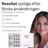 Mikro-Infusionssystem SE