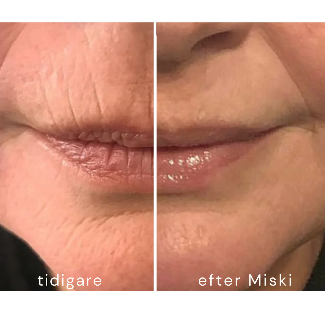 Mikro-Infusionssystem SE