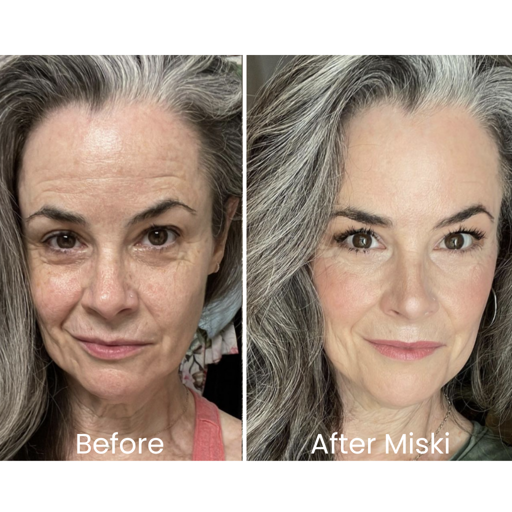 Miski Micro Infusion-System ENG