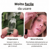 Miski Micro Infusion-System IT