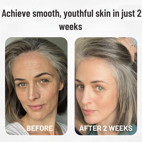 Miski Micro Infusion-System ENG