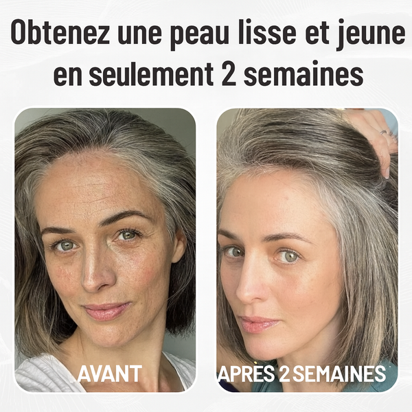 Miski Micro Infusion System FR