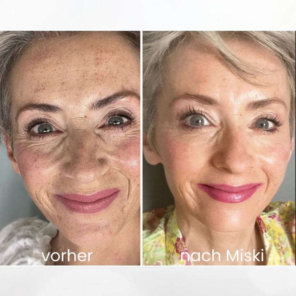 Mikro-Infusionssystem